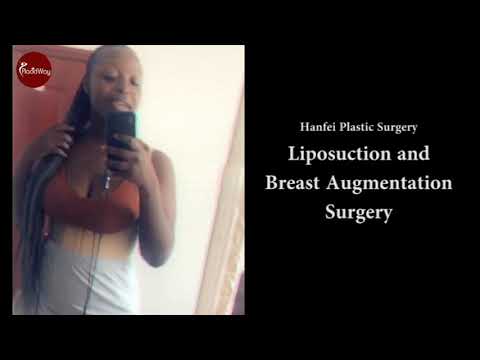 Liposuction and Breast Augmentation at Hanfei Plastic Surgery China