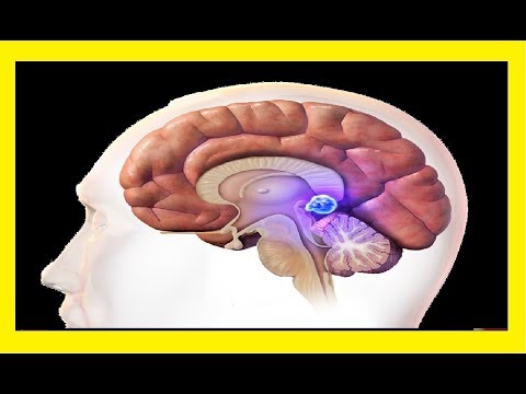 The pineal gland and the subconscious (Metaphysics of the Gods)