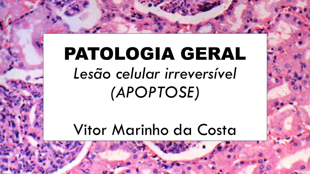 Lesões irreversíveis (APOPTOSE) - PARTE II