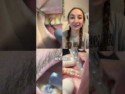 Cum să scapi de respirația urat mirositoare? 🤢