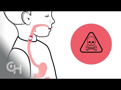 Lithium “Button” Batteries | Children's Hospital of Philadelphia