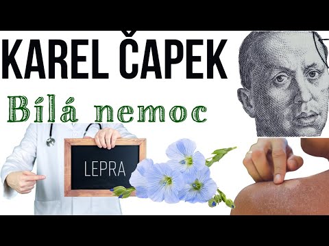 Karel Čapek - Bílá nemoc (rozbor díla k maturitě)