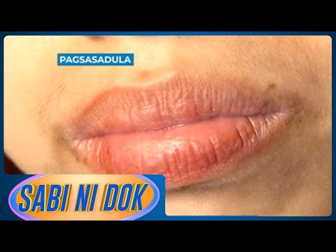 Sabi ni Dok: Solusyon sa dry lips | Gud Morning Kapatid