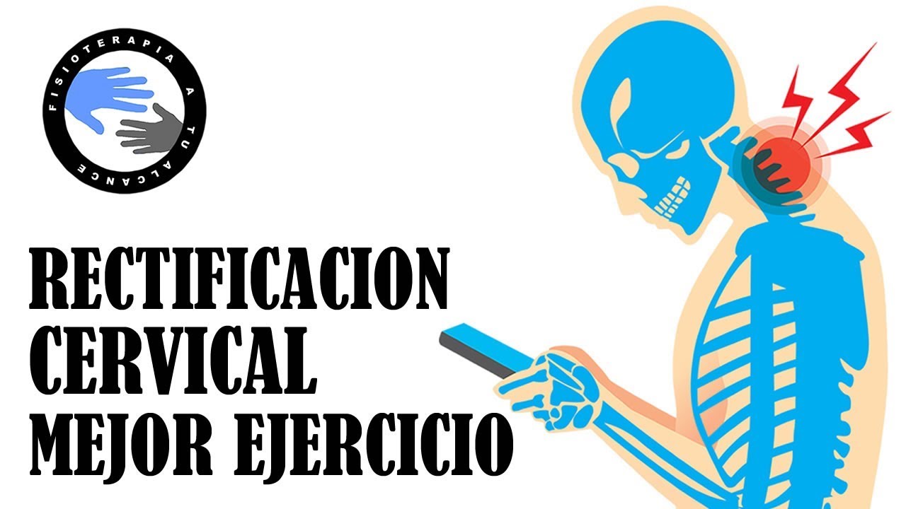 Descubre el mejor ejercicio para tratar la rectificacion cervical