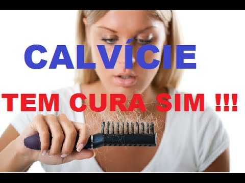 Calvicie Feminina Tem Cura  + reconstrução capilar + de Forma Natural