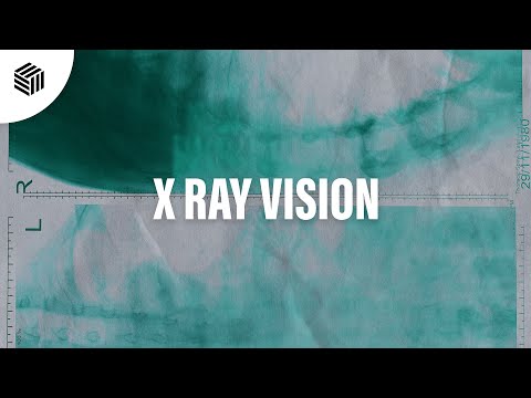MelonColly, L.A & Gavss - X Ray Vision (ft. Michael Shynes)