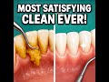 Say Goodbye To Plaque The Secret To A Sparkling Smile