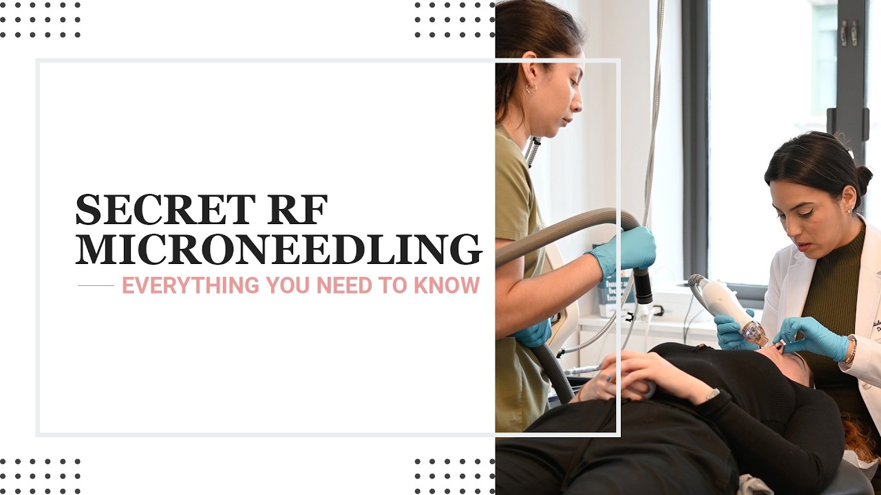 Radio Frequency Microneedling with Secret RF | Everything You Need to Know