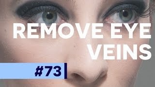 Remove Veins From Eyes - Photoshop CC Tutorial