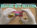 Bite Registration For A Denture