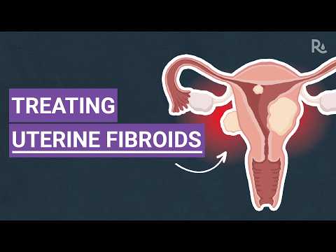 Uterine Fibroids: What Are the Symptoms and Treatment Options?