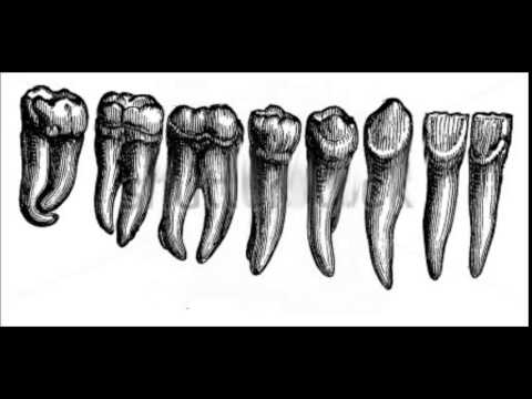 Suppurated Fetus  - "Small Birds sing in Chorus" DEMO   2015