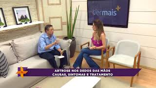 Como funciona a artrose nos dedos das mãos, descubra