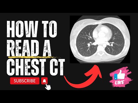 How to Read a Chest CT Scan Like a Radiologist (Beginner's Guide)