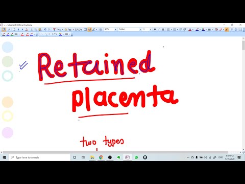 RETAINED PLACENTA- TYPES AND MANAGMENT -Short Lactures series