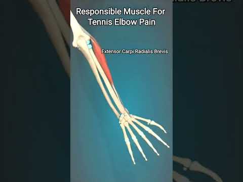 Easy Way to Treat Tennis Elbow Pain #shorts #elbow #pain #tenniselbow #health #massage