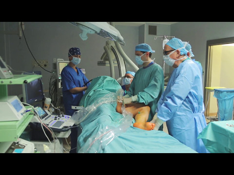 Usuwanie żylaków parą wodną VBOX w Szpitalu ESKULAP