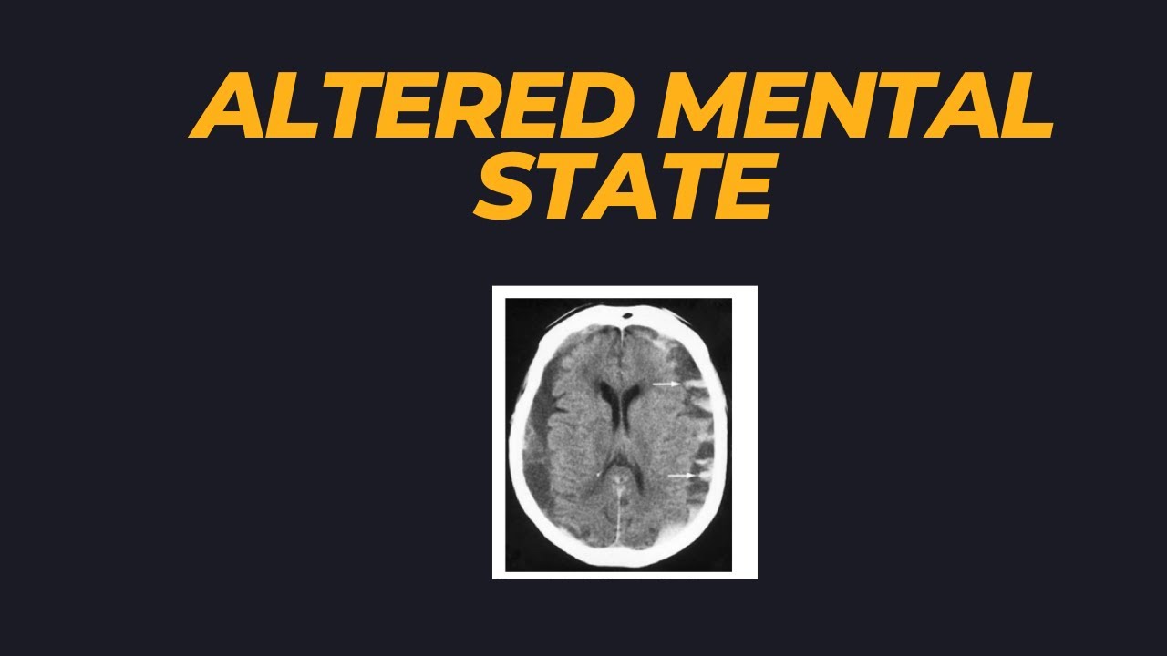 Altered mental state