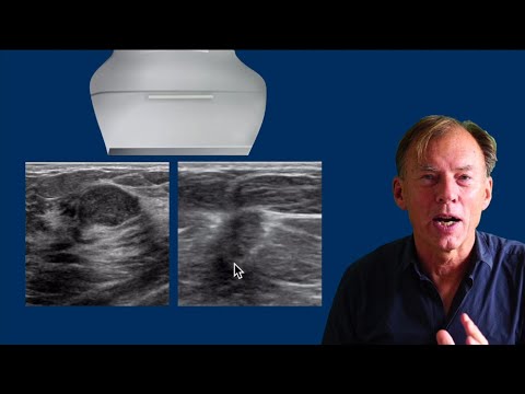 Ultrasound of the Breast - part 2