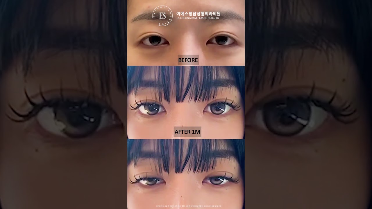 이에스 유튜브