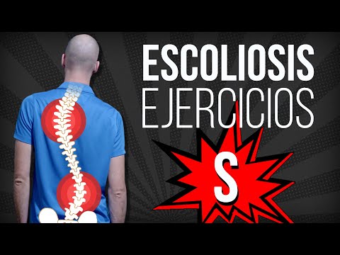 ESCOLIOSIS en S 👉 EJERCICIOS correctivos