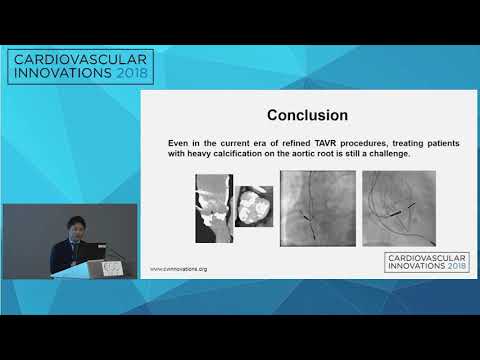 CVI2018 Session: Possible early recoil in a self-expandable transcatheter bioprosthesis
