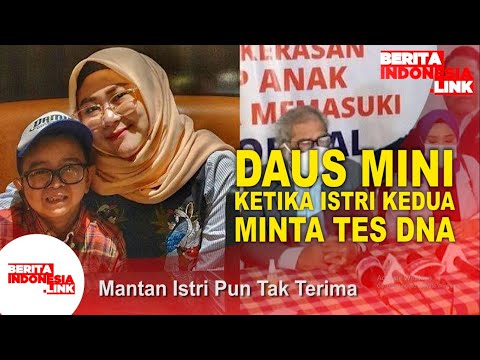 Daus Mini Tersandung Perkara Tes DNA
