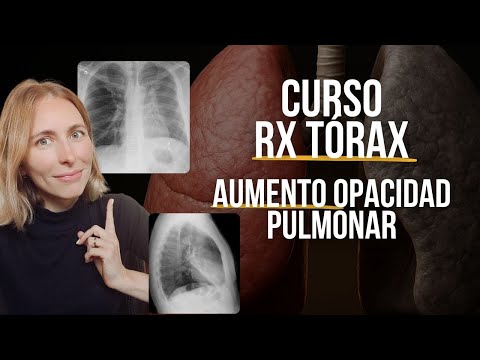 Do you know how to read a chest X-ray? Let's get started!