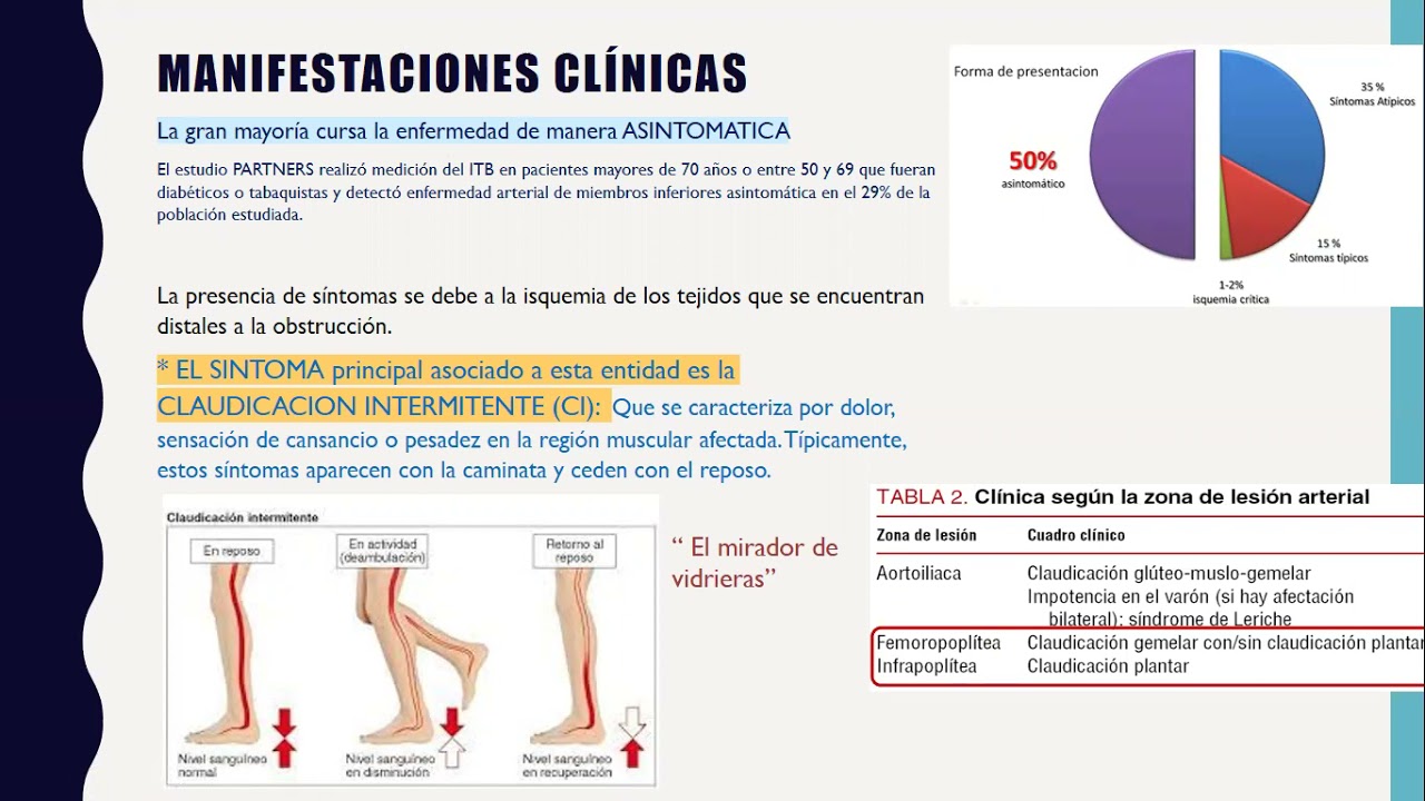 Enfermedad arterial de miembros inferiores