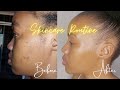 My skincare routine for acne | Under R50! | South African YouTuber