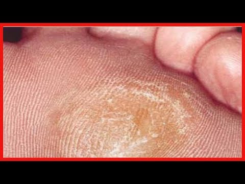 download lagu mp3 mp4 Pied Enlever La Corne, download lagu Pied Enlever La Corne gratis, unduh video klip Pied Enlever La Corne