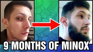 Minoxidil Beard | Week 39 | 9 MONTHS! | Bonus Progress Slideshow | #Facialfuzzfridays
