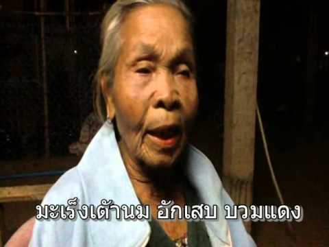 ทาสบนหน้าอกเล็ก เทียมหน้าอกภายใต้ต่อม 250 มล.