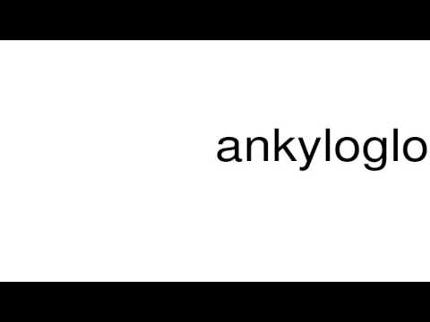 How to pronounce ankyloglossia