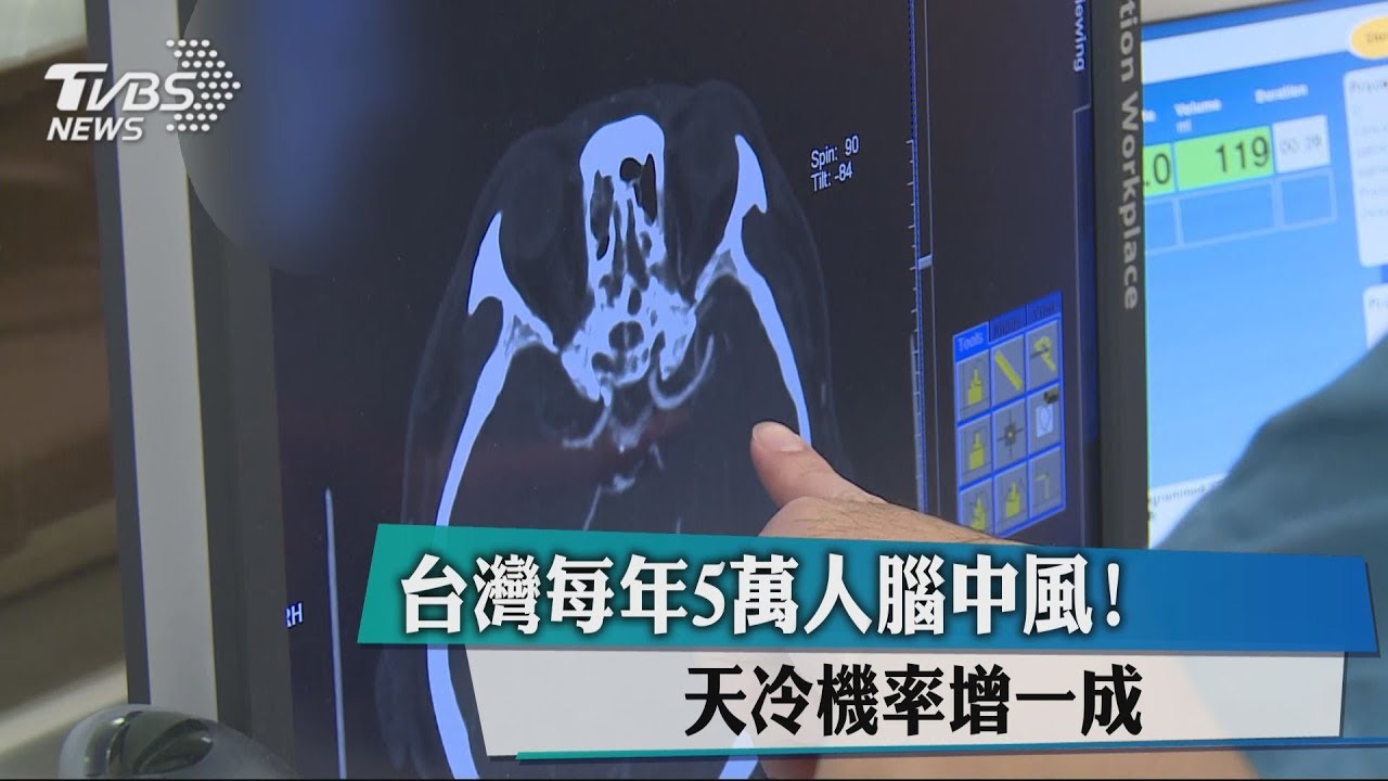 台灣每年5萬人腦中風! 天冷機率增一成