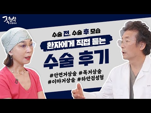 통증은? 관리는? 달라진 점은? 환자에게 직접 듣는 솔직한 수술 전과 수술 후 이야기!  #안면거상술후기  #목거상술후기 #하안검수술 #내시경이마거상술