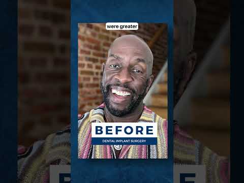 Do Dental Implants Make You Look Younger?