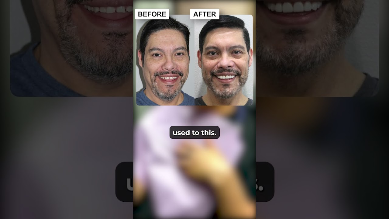 David Verdugo's Smile Story
