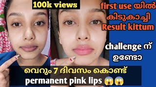 വെറും 7  ദിവസം കൊണ്ട് 😱pink lips naturally at home //How to get pink lips at home Malayalam //