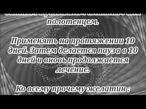 Рентгенограммы шейного отдела Остеохондроз и ощущения женщины