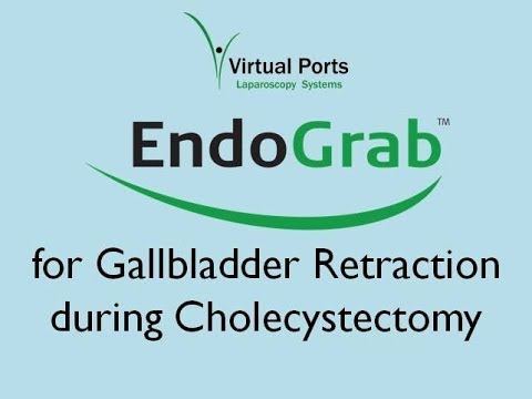 EndoGrab for Gall Bladder Retraction During Cholecystectomy logo