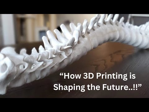 3D Printing in Spinal Implants | Dr. Ajay Kothari