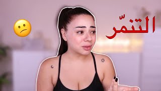 ردي على حملة التنمر عليّ 😱