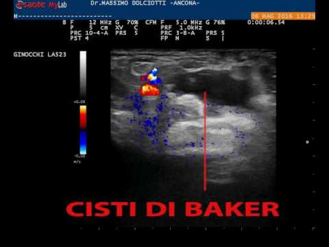 Con dolori lombari dolorante allinguine Articolazioni doloranti unguento