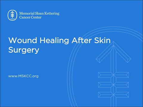 Wound Healing After Skin Surgery | Memorial Sloan Kettering Video