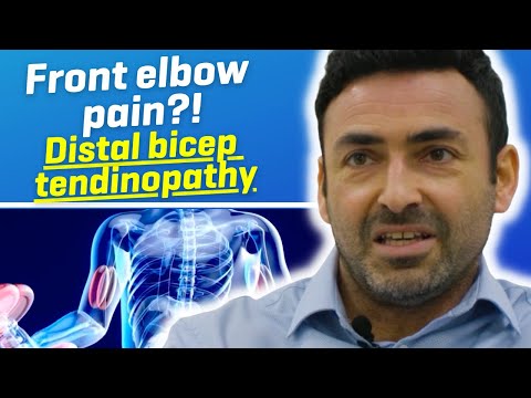 What is distal biceps tendinopathy?
