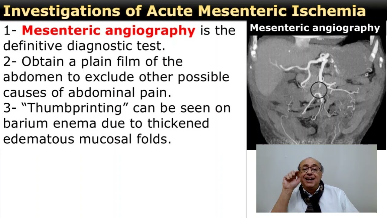 Acute Mesenteric Ischemia