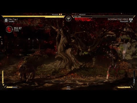 Yuvility vs Tweedy KL Set