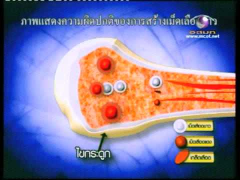 22 แรงยากจน ฟังในวันนี้ทีมรัสเซียกระเจี๊ยวขนาดเล็ก