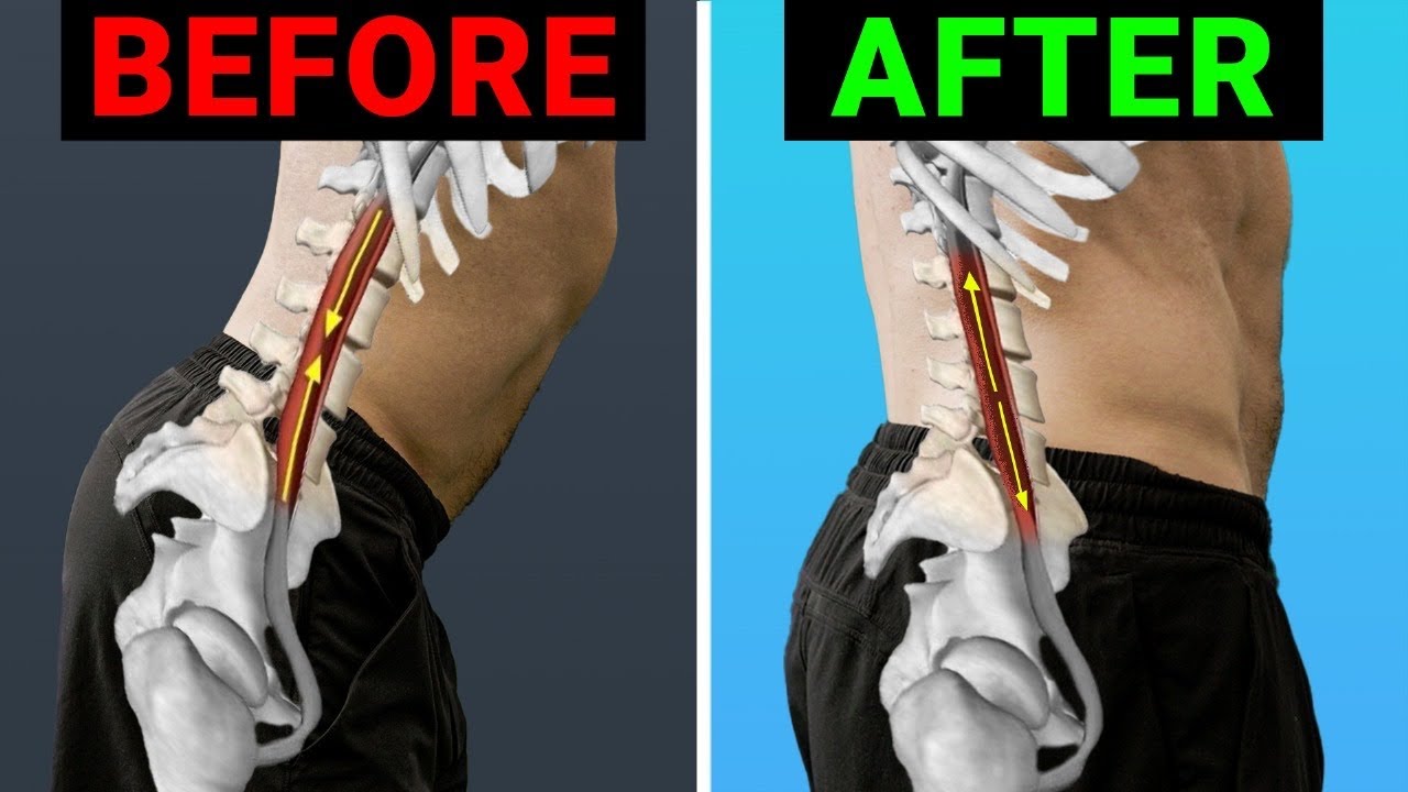 This Will Actually Fix Your Tight Psoas (without stretching)